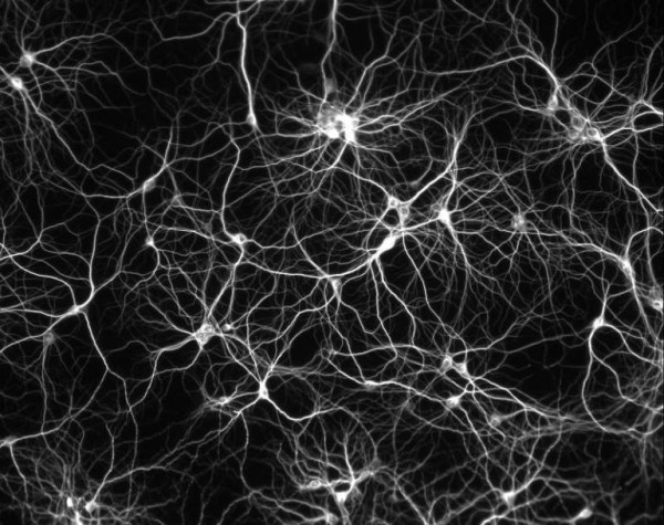 neuronnet.jpg